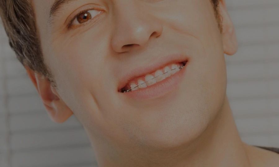 Young man with clear braces smiling