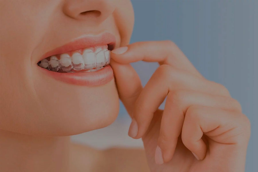 Are Hidden Braces Right for You