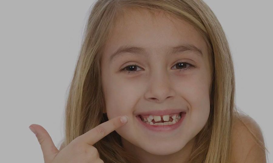 Girl-With-Crooked-Teeth-Fast-Treatment