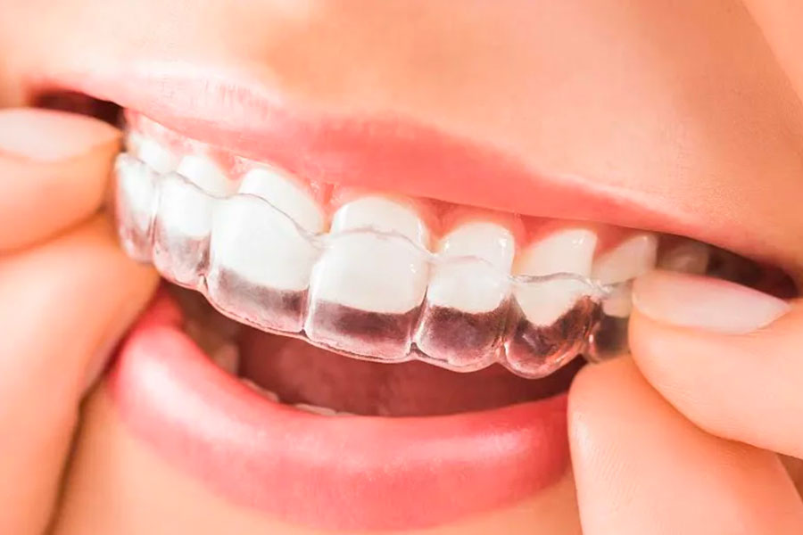 https://www.cityorthopeds.com/wp-content/uploads/2019/04/Woman-Adjusting-To-Her-New-Invisalign-Trays.jpg
