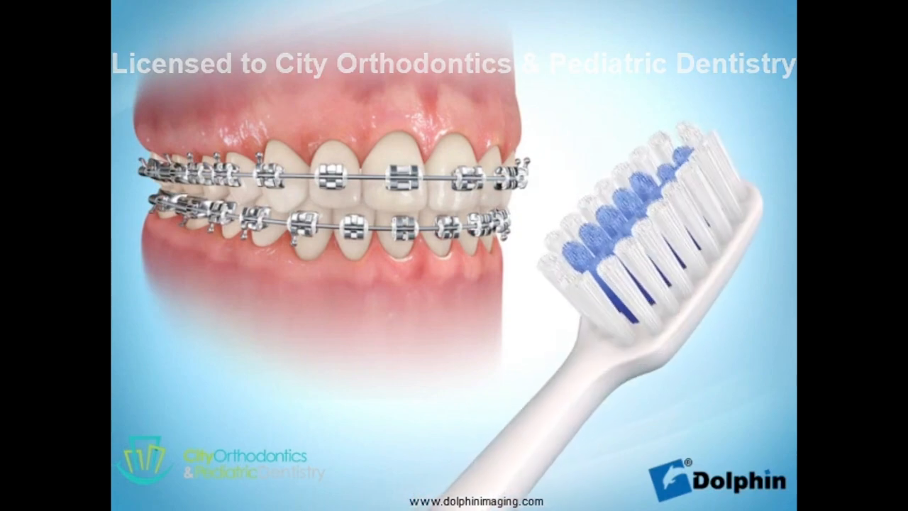 City Orthodontics & Pediatric Dentistry | Patient Educational Videos